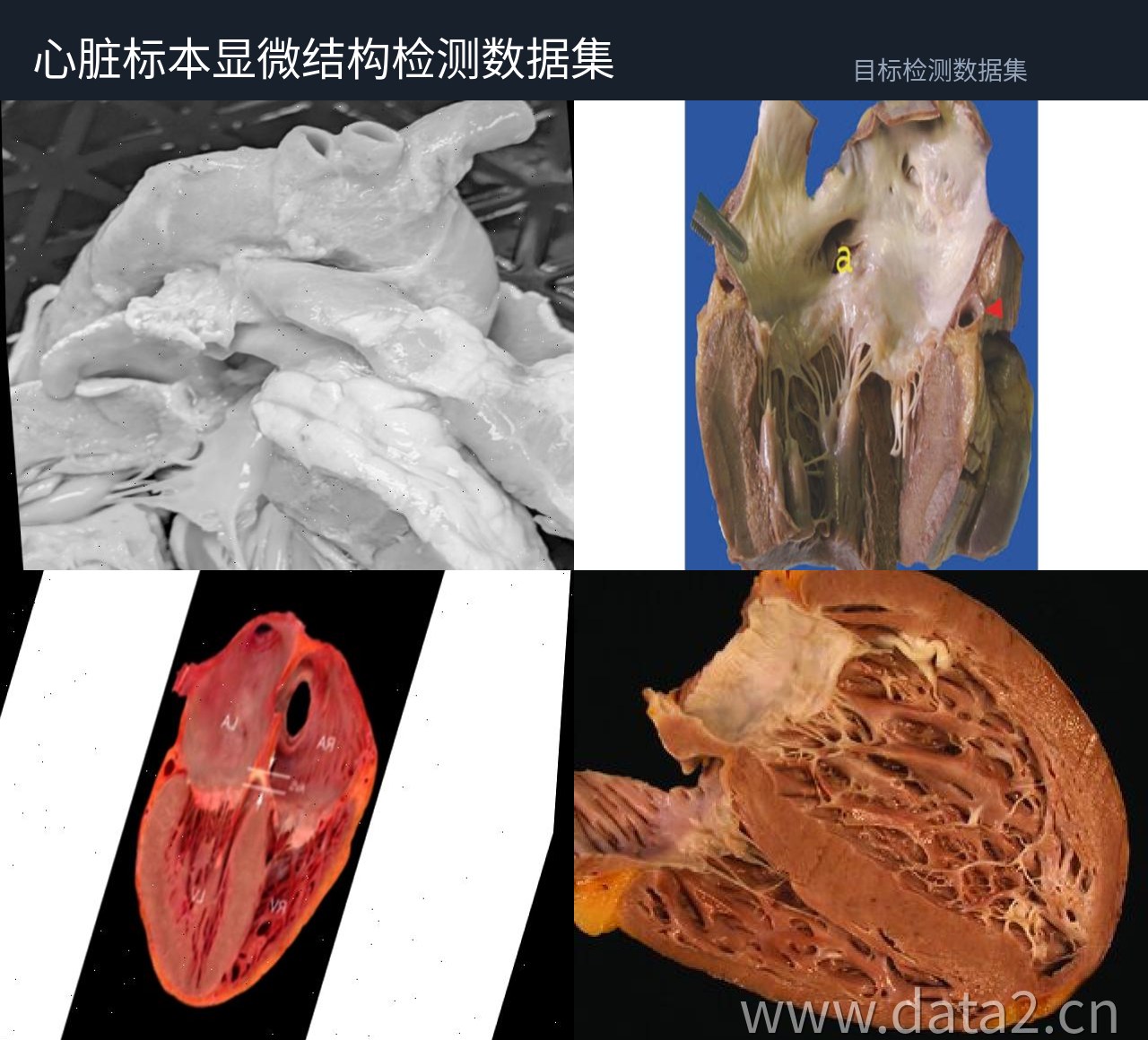 心脏解剖标本检测数据集 预览图