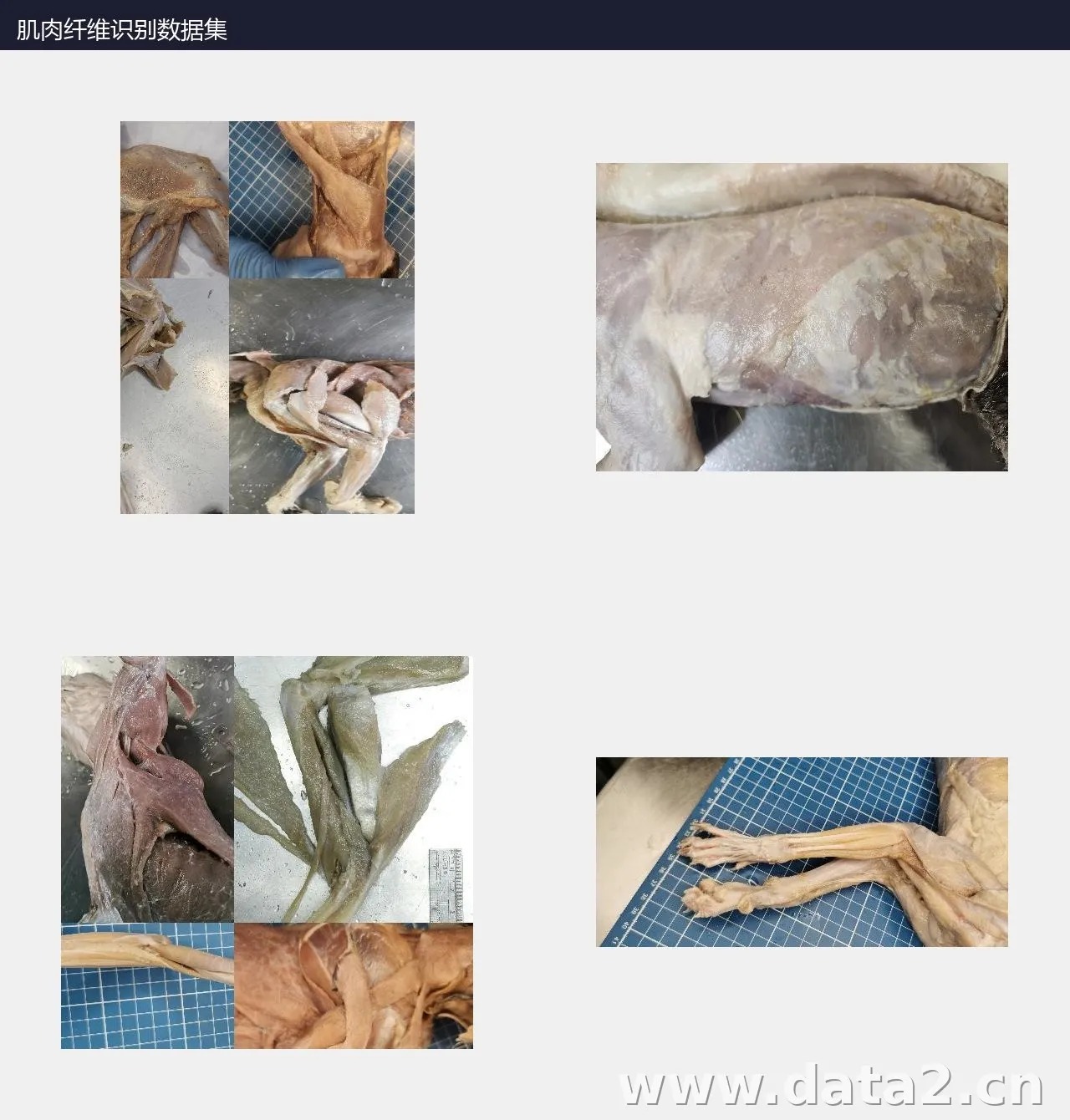 肌肉纤维组织识别数据集 预览图