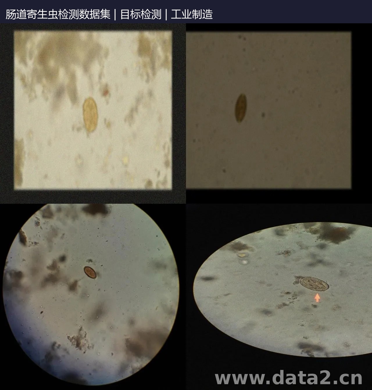 肠道寄生虫检测数据集 预览图